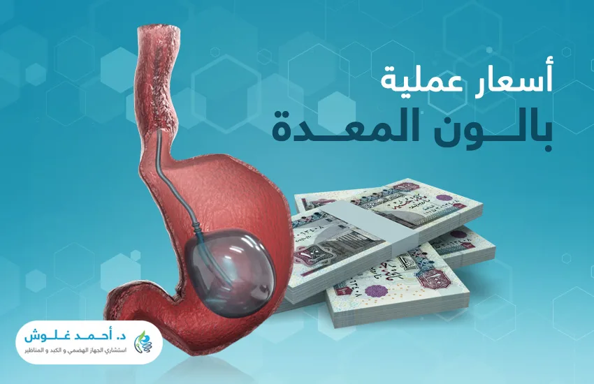 علام يعتمد سعر عملية بالون المعدة في مصر؟