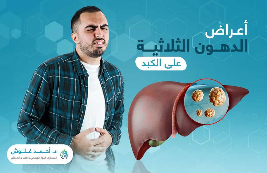 اعراض-الدهون-الثلاثيه-على-الكبد اعراض الدهون الثلاثيه على الكبد