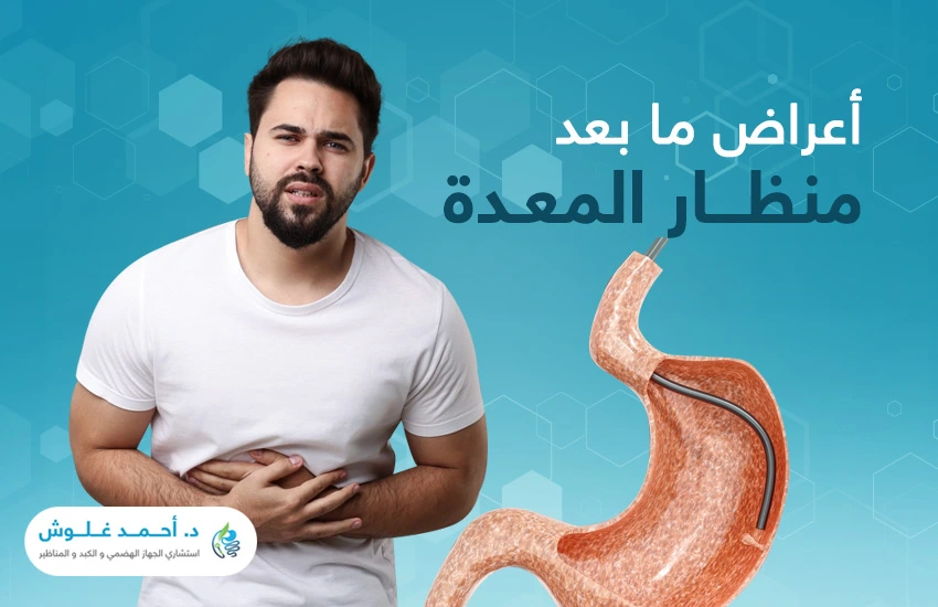 إلى متى تستمر اعراض ما بعد منظار المعدة؟