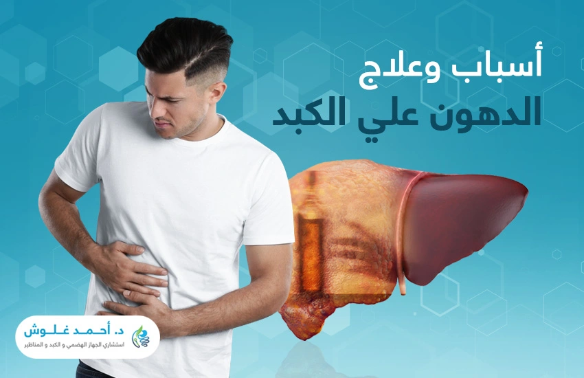 الدهون-على-الكبد-الاسباب-والعلاج الدهون على الكبد الاسباب والعلاج