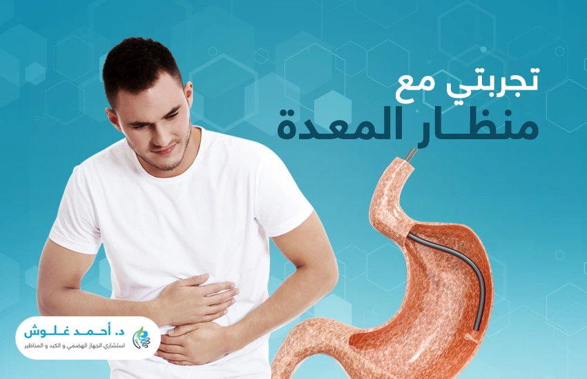 كيف ستكون تجربتي مع منظار المعدة؟