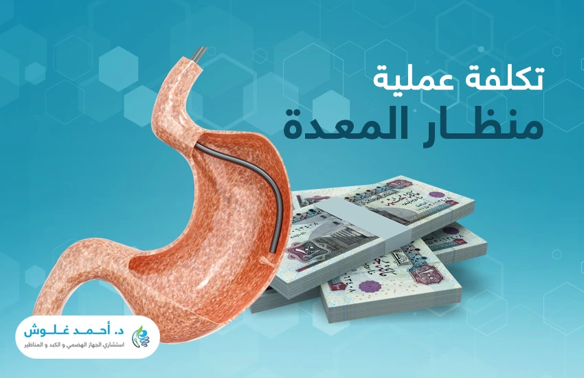 العوامل التي تؤثر في تكلفة منظار المعدة في مصر