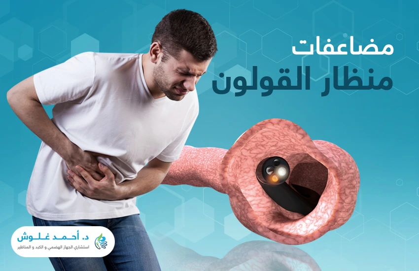 مضاعفات منظار القولون محدودة ولكن كن على دراية بها