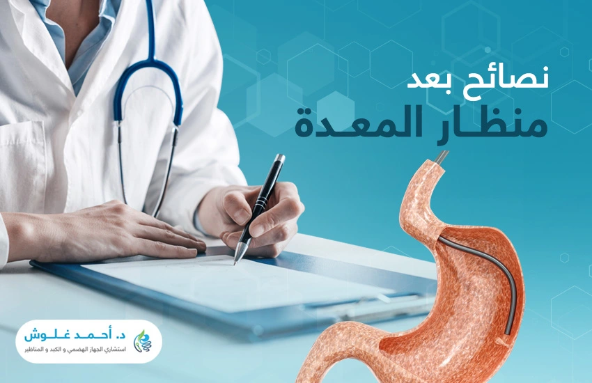 نصائح بعد عملية منظار المعدة للتعافي السريع دون مضاعفات