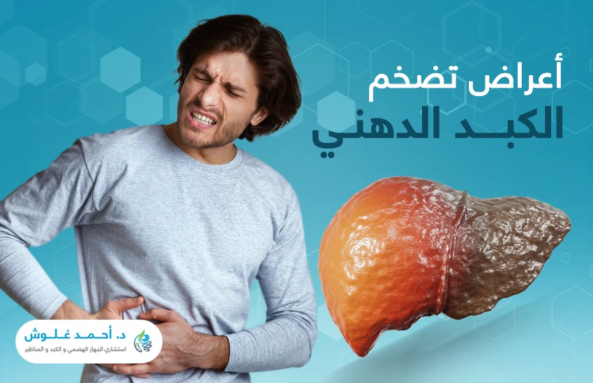 أعراض تضخم الكبد الدهنيl الوباء الخفي