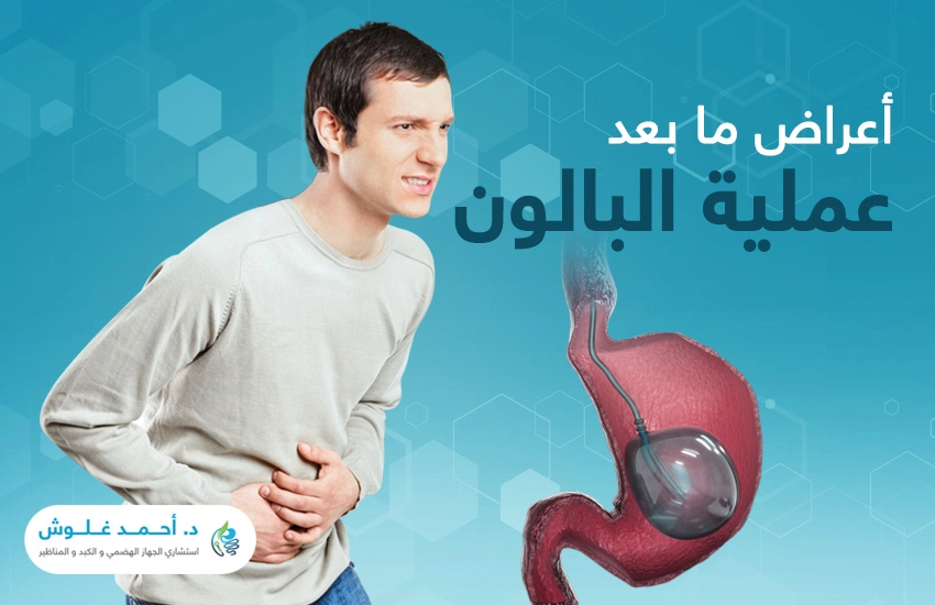 أعراض ما بعد عملية البالون .. اطمئن لبعضها واحذر من البعض الآخر