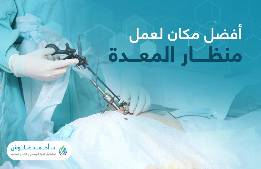 ما هو افضل مكان لعمل منظار المعدة؟