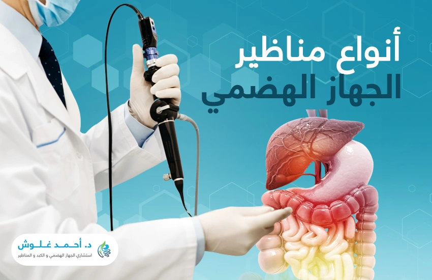 تعرف إلى انواع مناظير الجهاز الهضمي المختلفة
