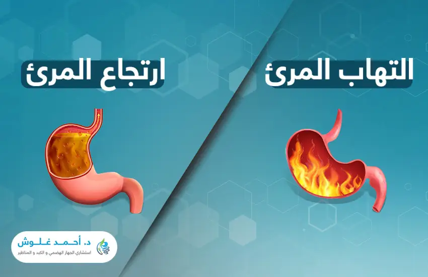 هل الأعراض كافية لاكتشاف الفرق بين التهاب المريء وارتجاع المريء؟