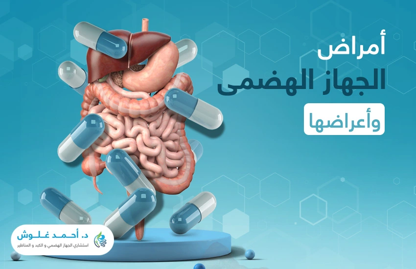 أمراض الجهاز الهضمي وأعراضها