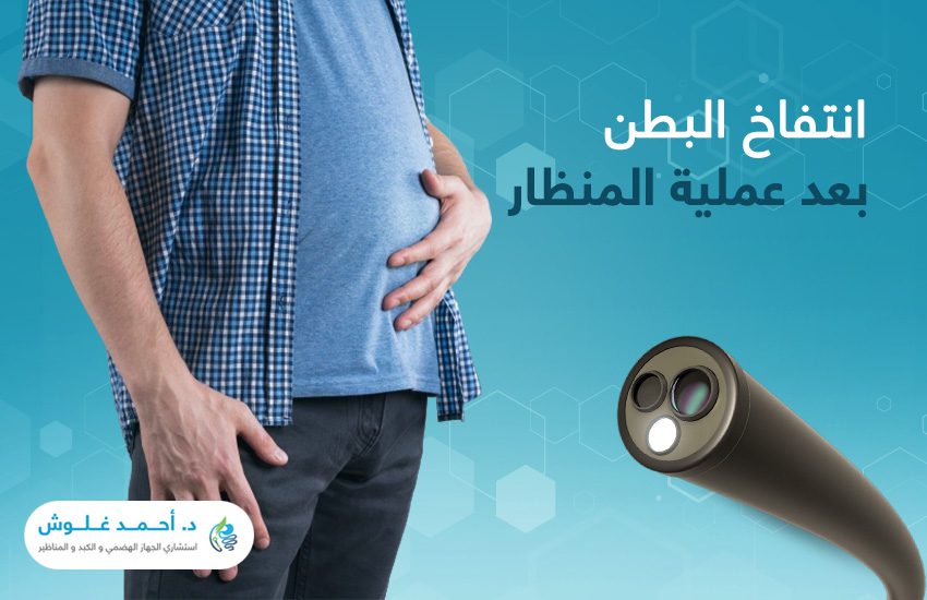 كيفية التخلص من انتفاخ البطن بعد عملية المنظار