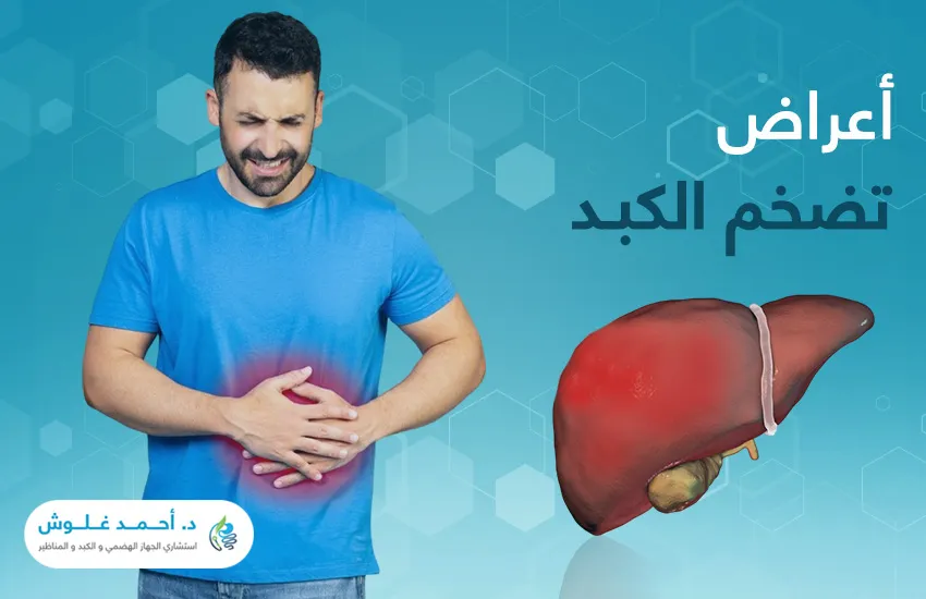 ما أعراض تضخم الكبد وعلاجه؟ 