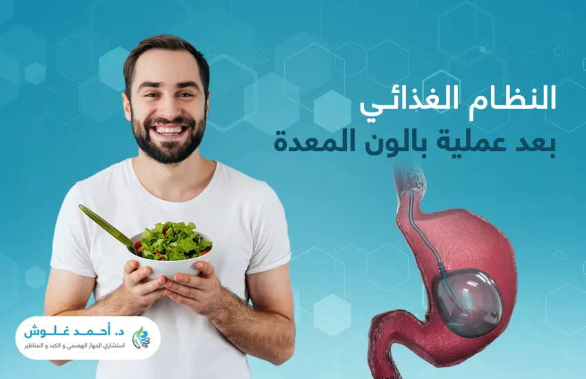 المسموح والممنوع في النظام الغذائي بعد عملية بالون المعدة