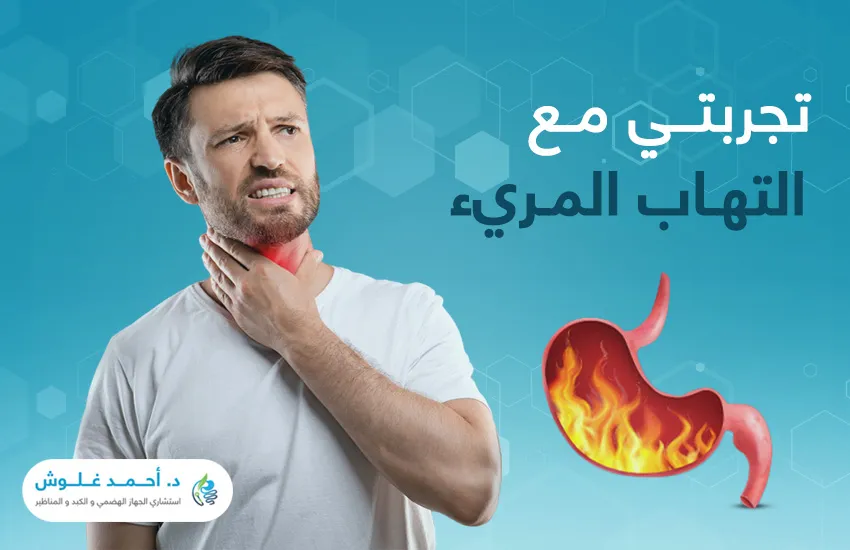 متى تنتهي تجربتي مع التهاب المريء؟