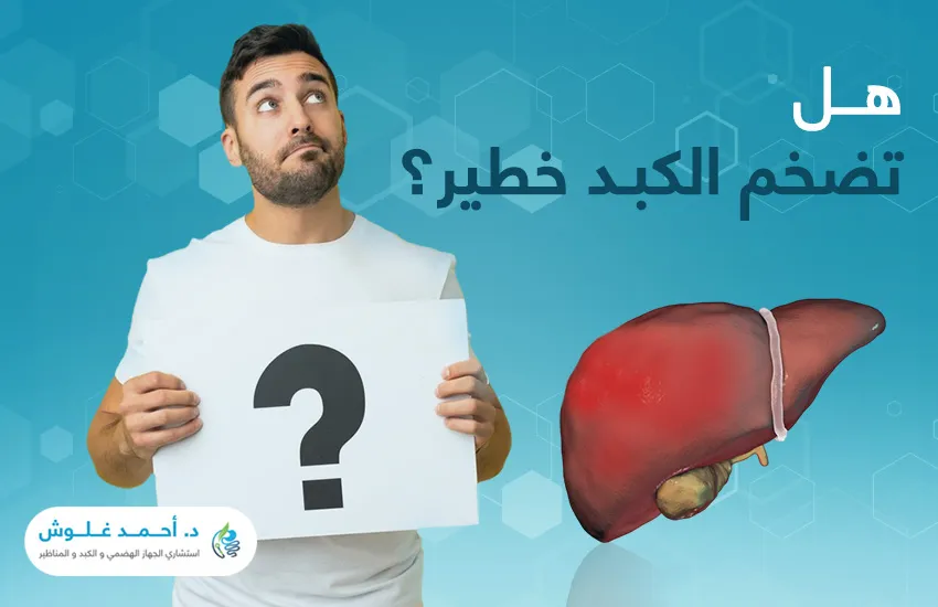 هل تضخم الكبد خطير؟