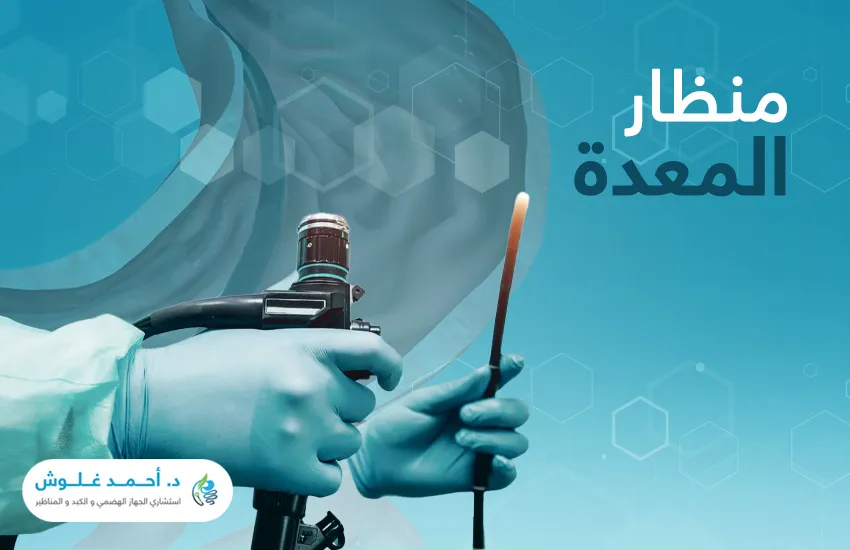 كل ما تحتاج إلى معرفته عن عملية منظار المعدة 