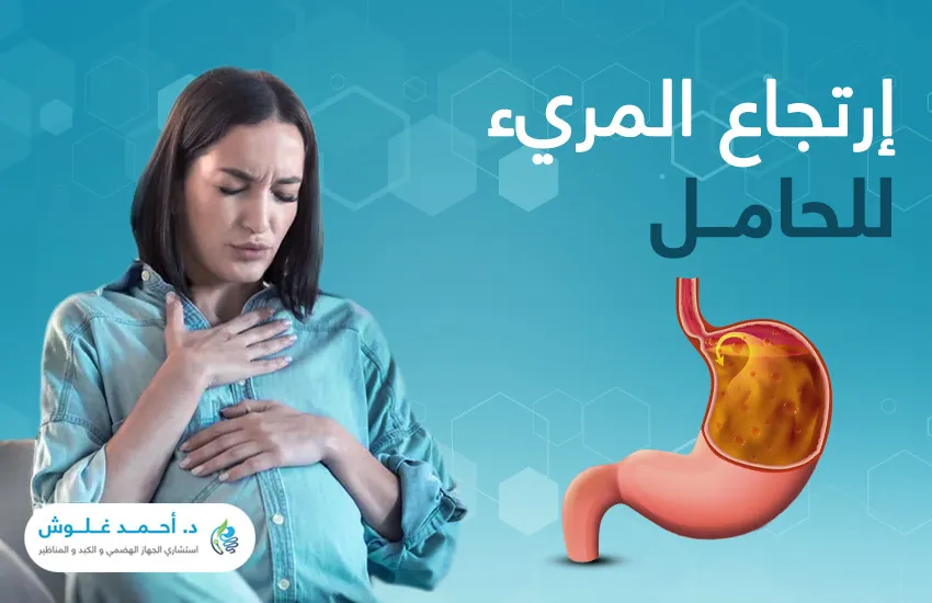 ارتجاع المريء للحامل: أسرار للتغلب على الحموضة وحرقة المعدة