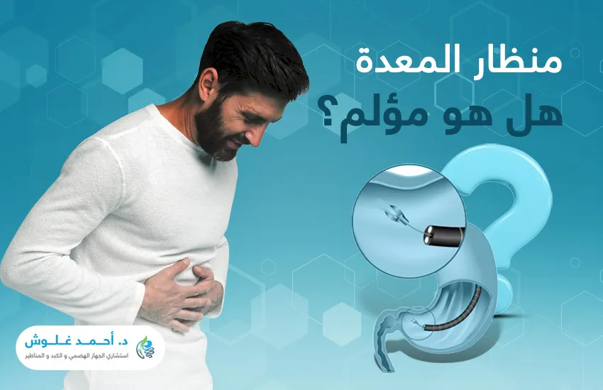 منظار المعدة هل هو مؤلم؟ 