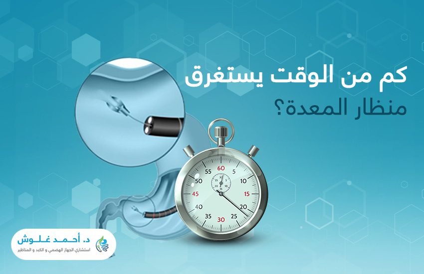 كم من الوقت يستغرق منظار المعدة؟ 