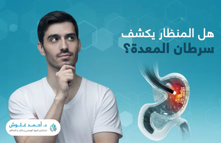 هل المنظار يكشف سرطان المعدة؟