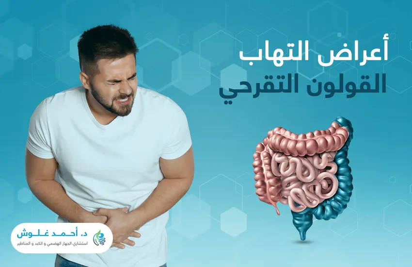 ما هي أعراض التهاب القولون التقرحي؟