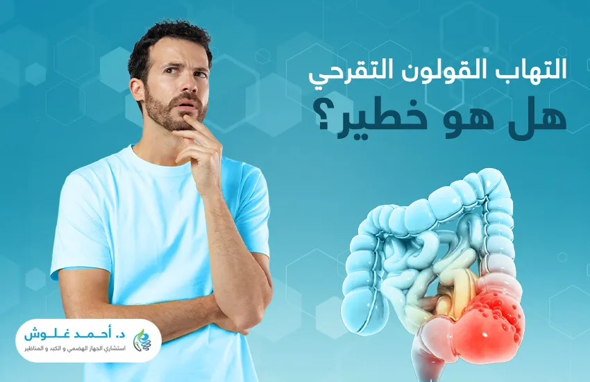التهاب القولون التقرحي هل هو خطير؟