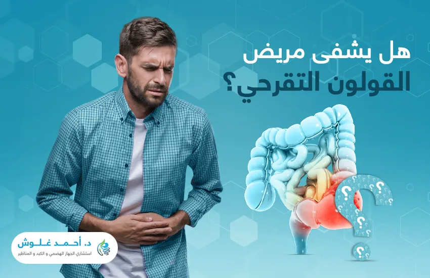 هل يشفى مريض القولون التقرحي؟