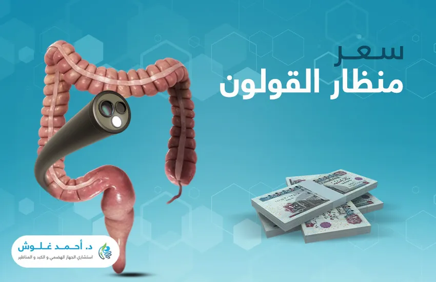 سعر منظار القولون في مصر