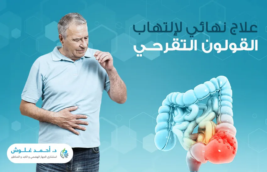 هل يوجد علاج نهائي لالتهاب القولون التقرحي؟