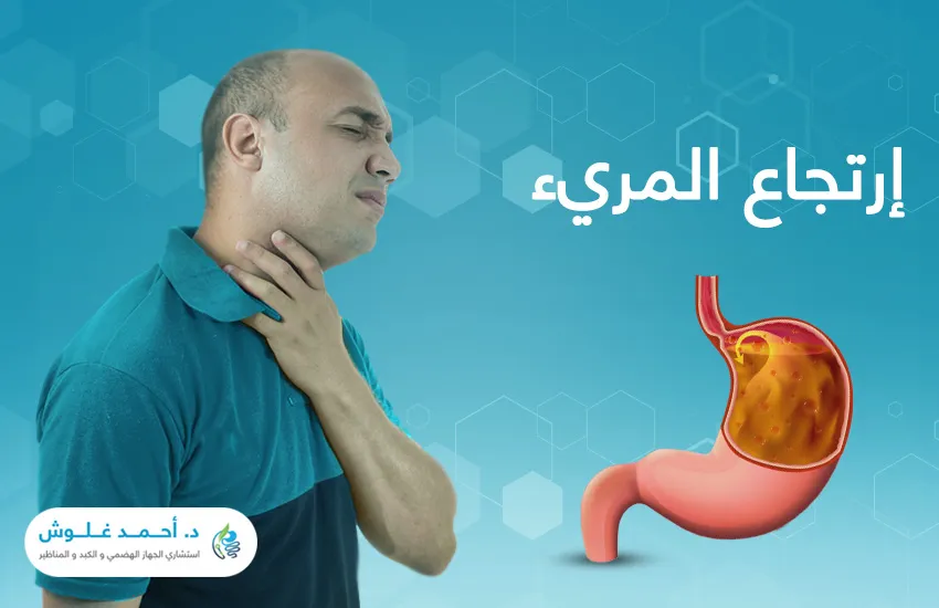 كل ما تريد معرفته عن ارتجاع المريء