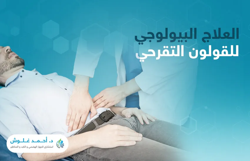 تعرف على العلاج البيولوجي للقولون التقرحي