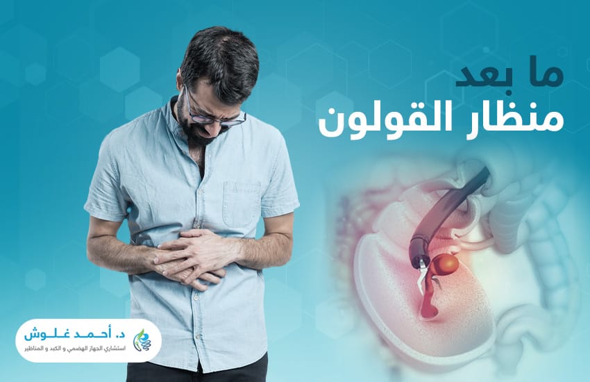تفاصيل مرحلة ما بعد منظار القولون: أهم الأعراض والتعليمات