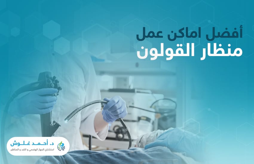 كيفية اختيار أفضل اماكن عمل منظار القولون