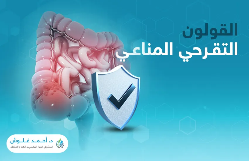 هل يمكن التعايش مع القولون التقرحي المناعي؟