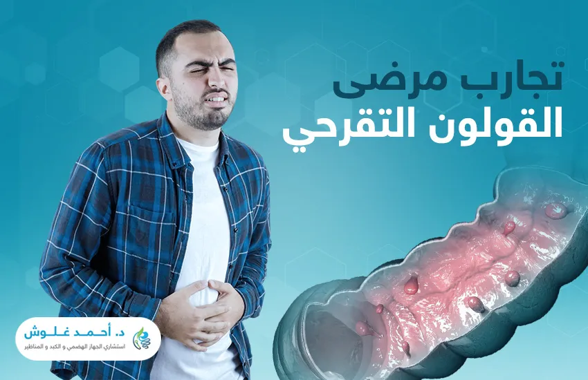 كيف نجحت تجارب مرضى القولون التقرحي؟