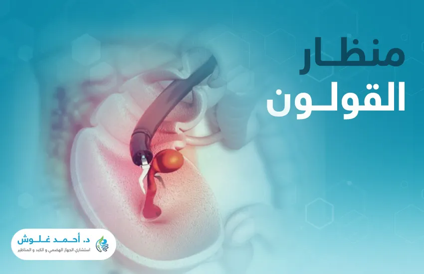 منظار القولون: جولة استكشافية داخل الأمعاء الغليظة والمستقيم