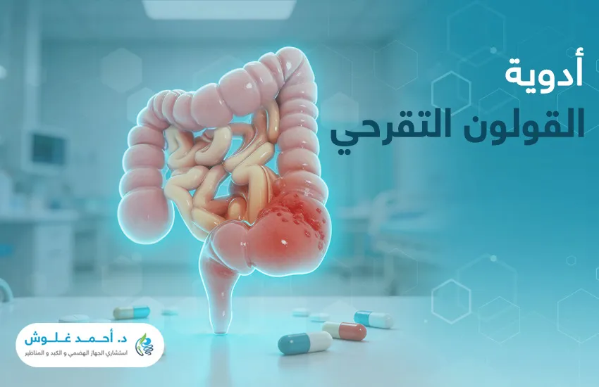 أدوية القولون التقرحي: دليل شامل لفهم خيارات العلاج المتاحة